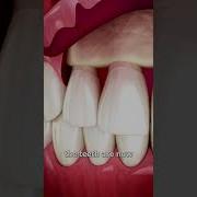 Emergency Super Flue S Gentle Dental Nurse R