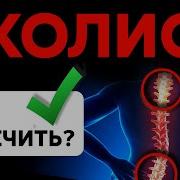 Позвоночник Сколиоз