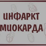 Инфаркт Микарда