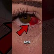 Отрывают Меня От Больных