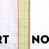 How To Get Rid Of The Bust Dart Quick And Easy