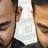Eugenix Hair Transplant Review Patient Experiences Before After Results And Testimonial