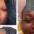 Her Nose Job Has Got People Talking About Ethnic Rhinoplasty And Whoville Noses