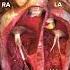 Heart Chambers Heart Heartanatomy Anatomy Cardiology Animation Shorts