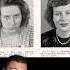 People Before And After Lobotomies Part 4 Disturbing