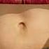 What Causes An Outie Belly Button