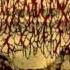 Medic Vomiting Pus Sound Of Complete Dislocation Of Cervial Vertebra