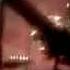 Nudist Colonies Of The World Camel Mp4