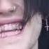Lil Peep Fingers Music Video