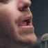 Post Malone Chemical Rock Cover By Our Last Night