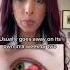 Did You Wake Up With Blood In Your Eye Eye Doctor Explains Shorts Health Eyes