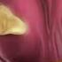 What Is Acid Reflux Animation