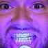 Summer Braces Hack
