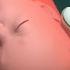 Normal Vaginal Childbirth