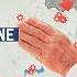 Putin S War On Ukraine Explained