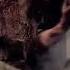 Dr Salvador In The Resident Evil 4 Remake