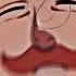 Hypothetically We All Know Where This Is Going Edit