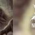 Cerebral Extinction Necro Parasite Anomaly 2017 Full Album