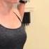 Roos Test Thoracic Outlet Syndrome