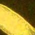 Stenostomum Tuberculosum