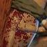 The Man Who Cut Off His Own Arm