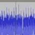 Heart Sound Recorded On Mp3 Player