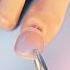 How Toenail Removal Works