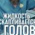 Гидроцефалия головного мозга в простонародье водянка