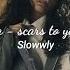 Alessia Cara Scars To Your Beautiful Slowed Reverb
