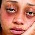 Student Bullied Every Day For Her Disorder Dhar Mann Studios