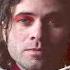 The Technicolors Hurt So Bad