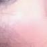 RHINOPLASTY You Have The Most PERFECT Nose Ever