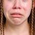 Girl With ALBINISM SHAMED For Her Looks In SCHOOL Dhar Mann Studios