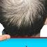 How To Help Regrow Your Hair UPDATED VITAL INFO