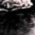 Ultrasound Of Our Baby Boy Kamola