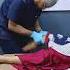 Patellofemoral Arthritis FIXED Best Chiropractic ADJUSTMENT With MASSIVE RESULTS