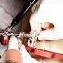 Surprising Waterproof Repair For Broken Bones