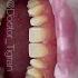 Dentist Dentistry стоматология стоматолог виниры Odontologia Dental Bleach Braces Veneers