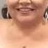 The Greatest Showman Actress Keala Settle Talks About Her Rare Brain Disorder
