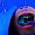 Mr Kiwi Eats More Sus Slime Emergency FruitSurgery DiscountDentist Ep 189 Shorts