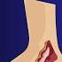 7 Warning Signs Of Blocked Heart Arteries In Legs And Feet Don T Ignore These Signals VisitJoy