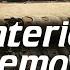 Complete Interior Trim Removal With Chapters Lexus LX470 And Toyota Land Cruiser 100 Series