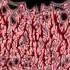 Medic Vomiting Pus Devour The Putrefying Corpse Of Finished Autopsy