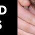 Thyroid Status Examination OSCE Guide UKMLA CPSA PLAB 2
