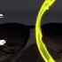 Stefan Gruenwald Lokee Feat Pearl Andersson Wonderful Life
