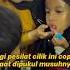 Gigi Pesilat Cilik Ini Copot Saat Dipukul Musuhnya