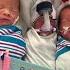 North Texas Couple Thought They Were Having Twins But Got Triple The Blessings NBCDFW