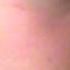 What Happens When U Get Hit In The Face With A Basketball At Practice