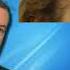 Female Temple Sideburn Hair Transplant Results At 5 Years By Dr Lindsey McLean Virginia DC