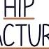 Understanding Hip Fractures And Hip Surgery